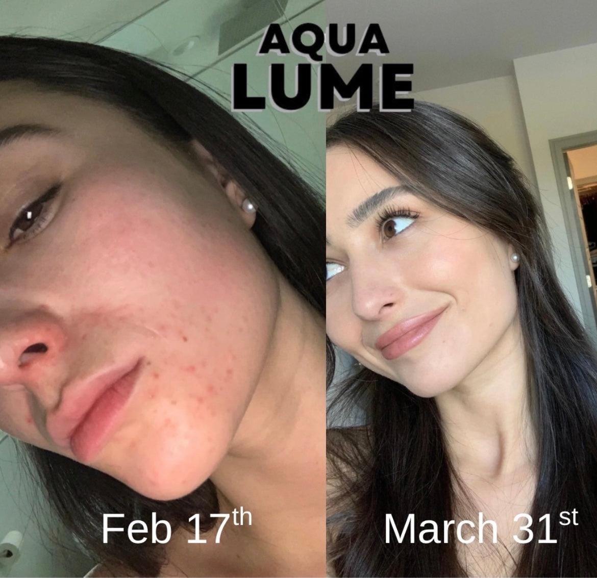 AQUA LUME SHOWER HEAD